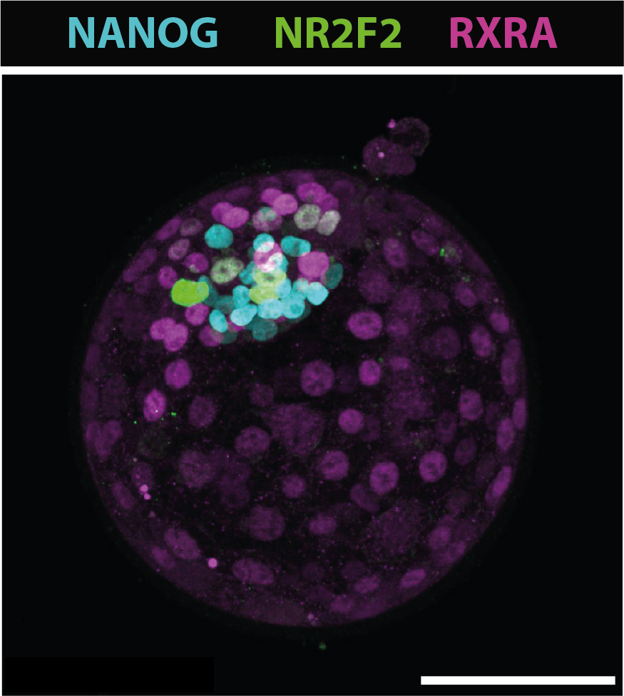 imagerie blastocyst